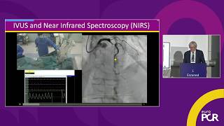 The Future of Coronary Imaging: IVUS + NIRS for Better Patient Outcomes