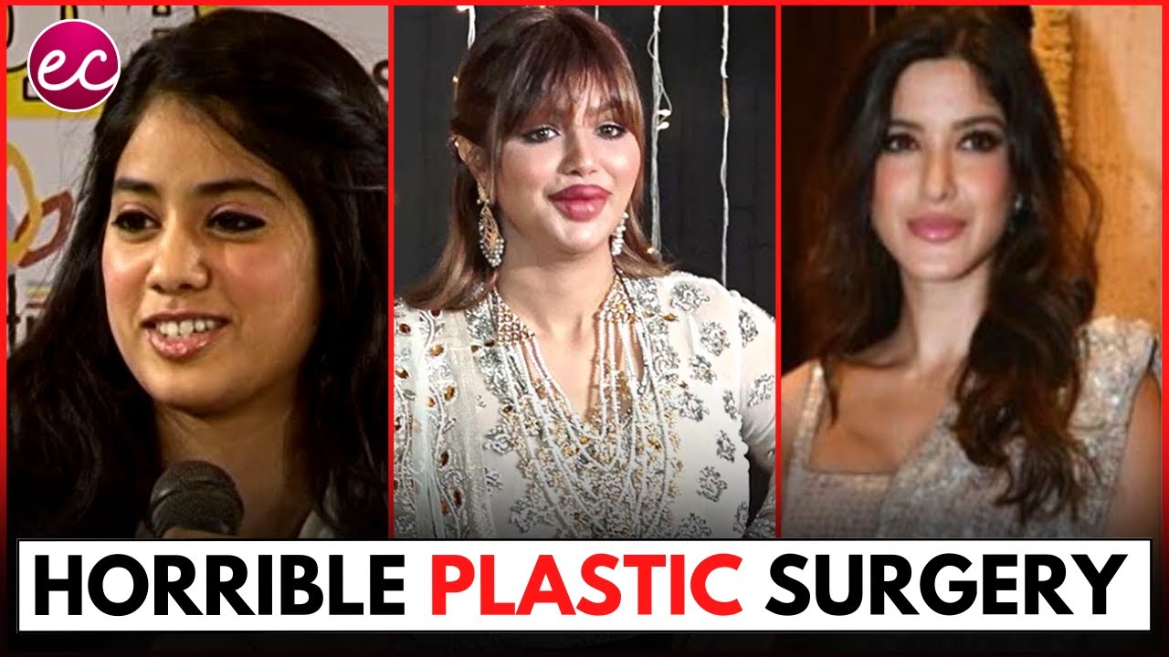 20-before-and-after-bollywood-actress-shocking-plastic-surgery-youtube