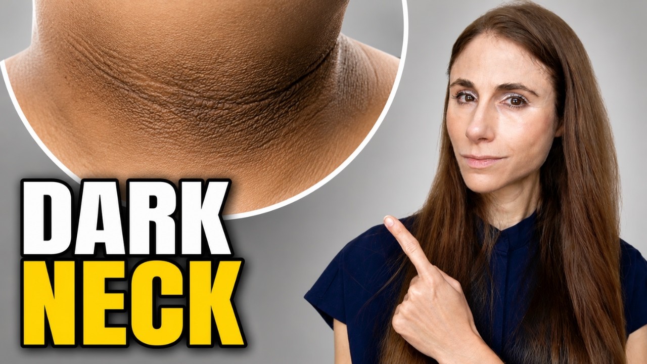 Acanthosis Nigricans: A Warning Sign of Insulin Resistance