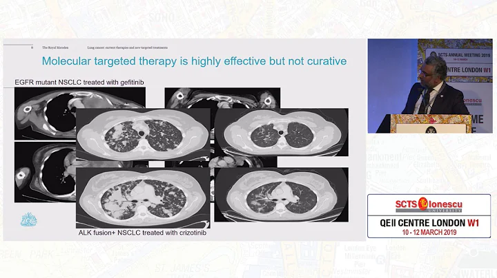 Lung Cancer: Current Therapies and New Targeted Treatments
