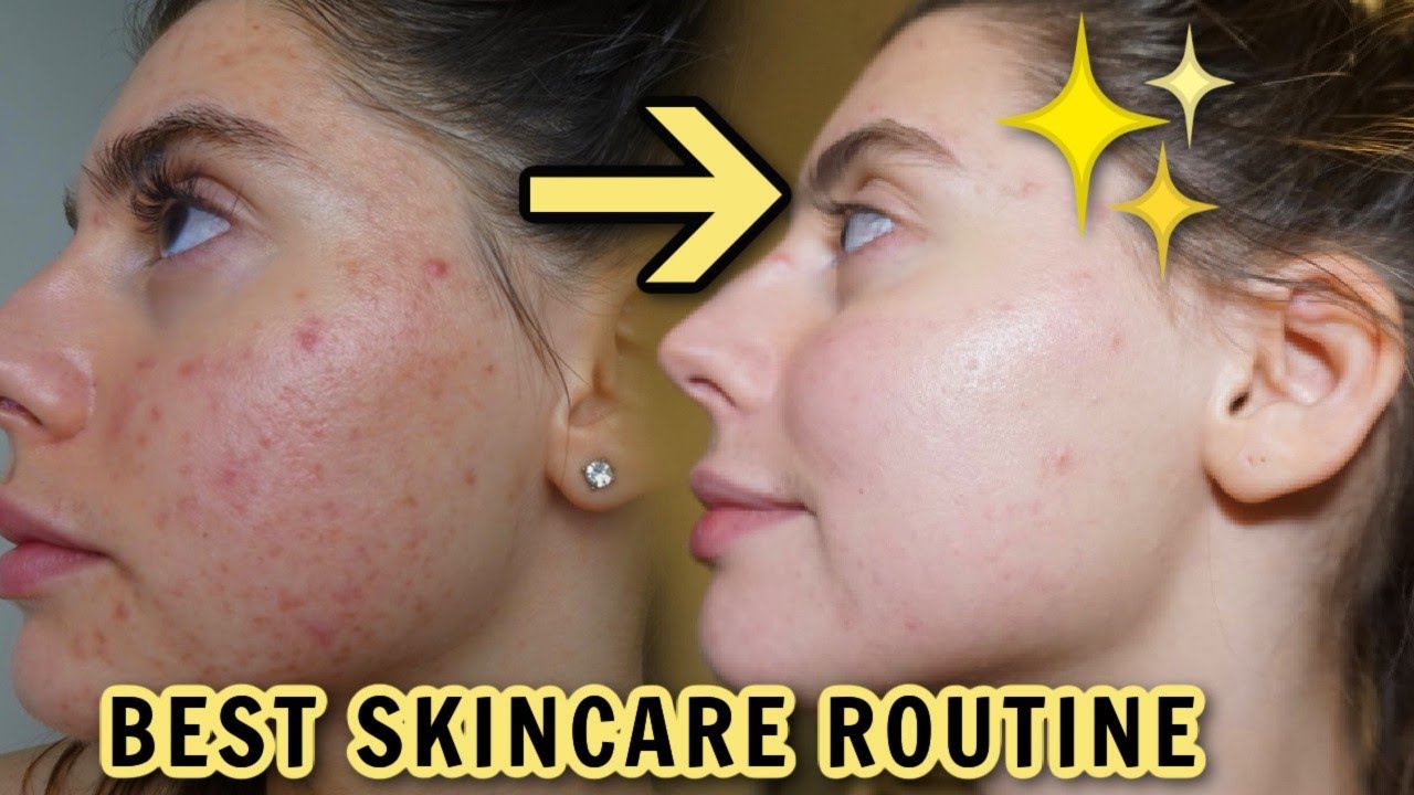 MY UPDATED SKINCARE ROUTINE FOR ACNE SCARS, CLEAR SKIN 2021!! - YouTube
