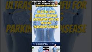 Bilateral High Intensity Focused Ultrasound HiFU for Treating Parkinson's Disease