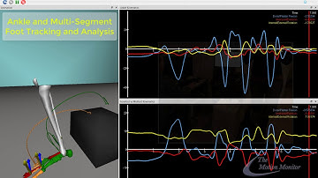 Multi-Segment Foot and Ankle Tracking & Analysis