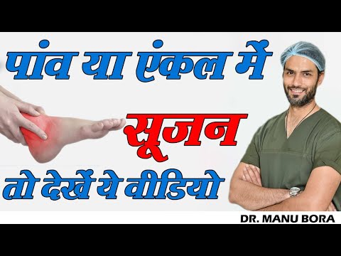 वीडियो: क्या मोजे में सूजन आ सकती है?