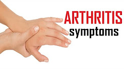 8 Early Signs Of Arthritis | Arthritis Symptoms