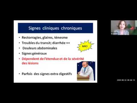 49. Maladies inflammatoires chroniques de l&rsquo;intestin (MICI) (Dr GAMAR)