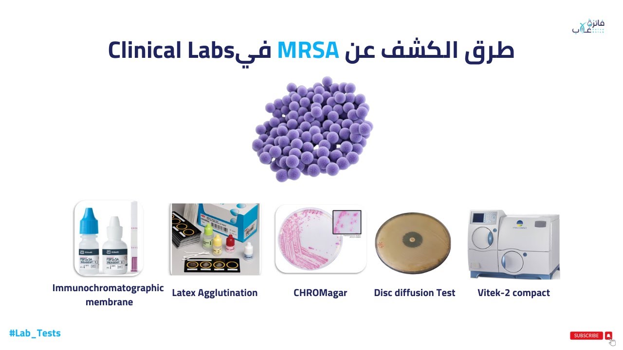 طرق الكشف عن Methicillin resistant staphylococcus aureus MRSA في Clinical Labs