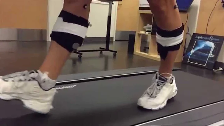 Glen Sather Sports Medicine Clinic: 3D Gait Analysis