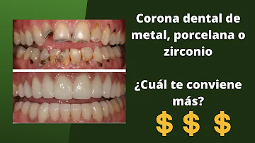 ¿Cuánto cuesta una corona dental 2023?