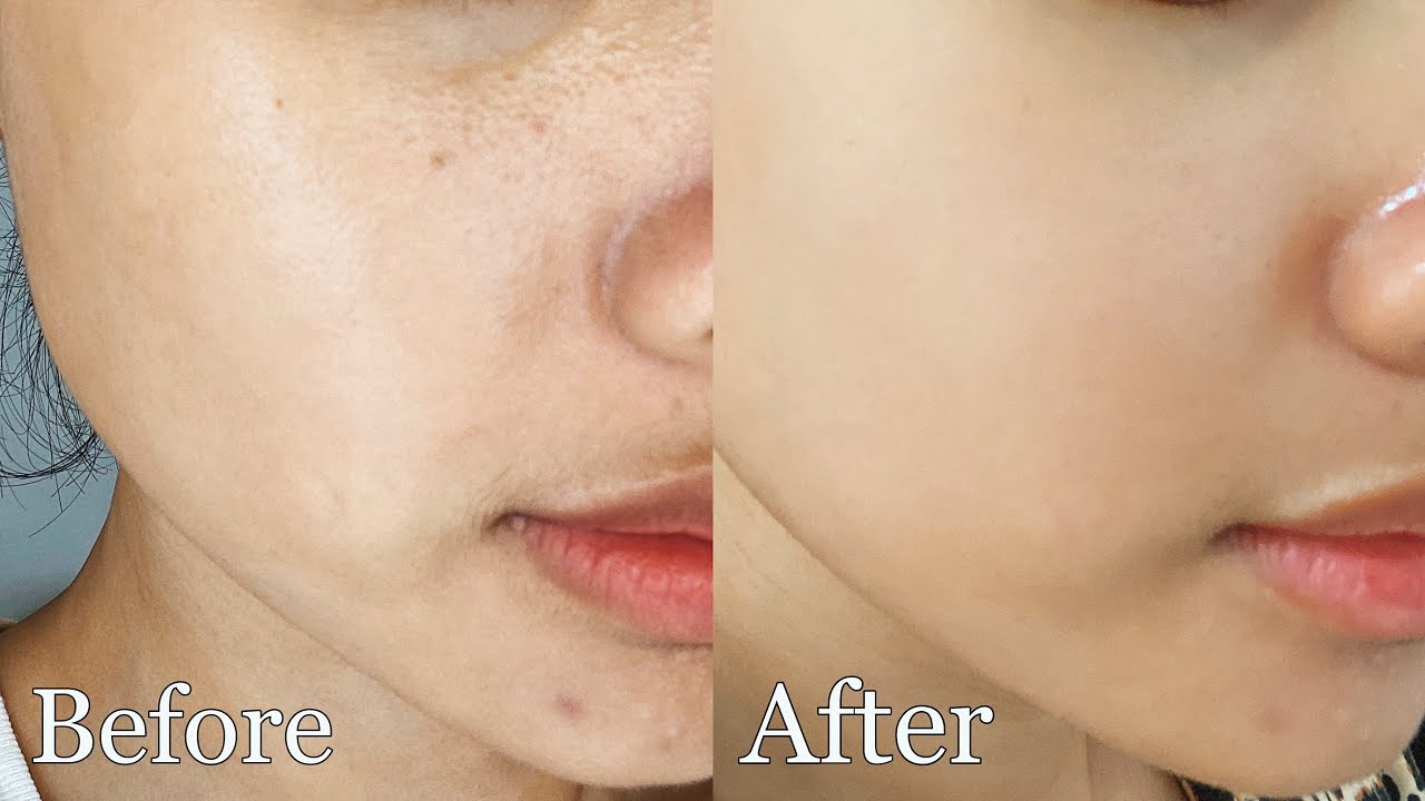 PENTING NYA EKSFOLIASI UNTUK KULIT + REKOMENDASI PRODUK UNTUK PEMULA