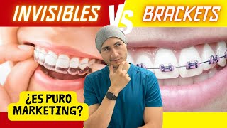 Brackets vs Invisibles | La verdad by Dr. Federico Baena Q 32,636 views 3 months ago 16 minutes