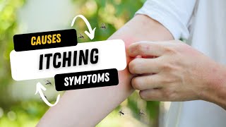 Causes of itching | treatment and Symptoms | Skin conditions