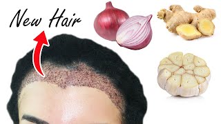 New hair appears from the first use / the most powerful recipe for hair growth on YouTube