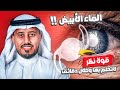 أحدث عمليات سحب الماء الأبيض وزراعة العدسات والتخلص من نظارات البعد والقراءة Phaco Multifocal IOL 