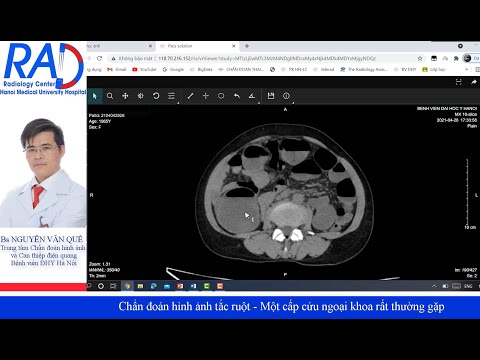 Video: Mô hình chẩn đoán là gì?