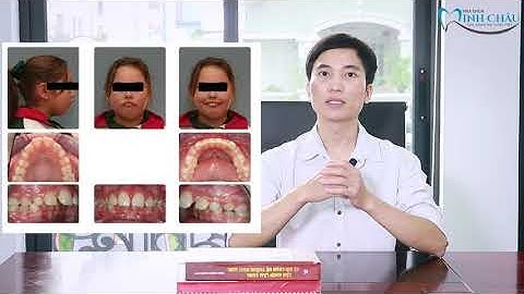 Hô Răng, Khớp Cắn Sâu Và Giải Pháp Điều Trị | Khí Cụ Twin Block