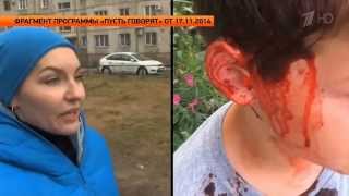 "Конфликт бийчан в эфире 1-ого канала" ("Новости ОТН", 18.11.14г., Бийск) "Конфликт бийчан в эфире 1-ого канала" ("Новости ОТН", 18.11.14г., Бийск)