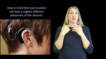 Cochlear Implants: Basics and Troubleshooting