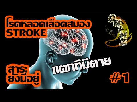 สาระยังมีอยู่ : โรคเส้นเลือดสมอง Stroke แตกทีมีตาย #1