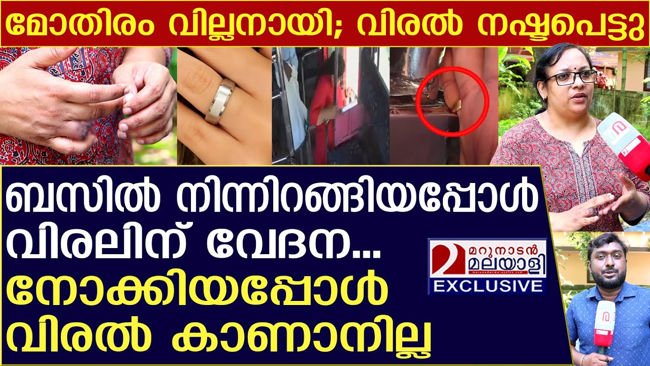 മോതിരം നിങ്ങളുടെ വിരൽ നഷ്ടപ്പെടുത്തിയേക്കാം | ring | Ring avulsion | bus | finger loss