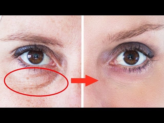 Se Débarrasser Des Cernes Sous Les Yeux en Seulement 3 Jours - YouTube