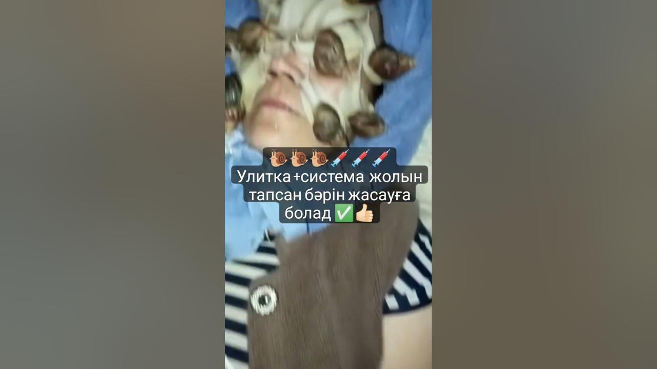 Терапия улитки🐌🐌🐌 - YouTube