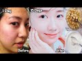 Japanese secret to whitening skin and get rid of pigmentation to get a fresh complexion