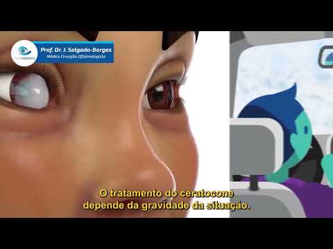 Prof. J Salgado Borges - Ceratocone