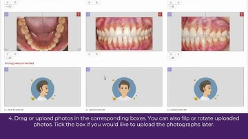 TrioClear™ & 3Shape link