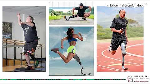 Sweat-Wicking Prosthetic Liner for Lower Limb Amputees | DEBUT Challenge 2022