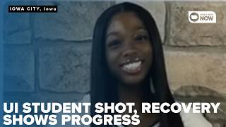 University of Iowa student shot in Iowa City showing signs of recovery as support grows