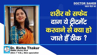 Dr. Richa Thakur से जानिए, Vitilgo क्या Treatment करवाने से हो जाता है ठीक ?