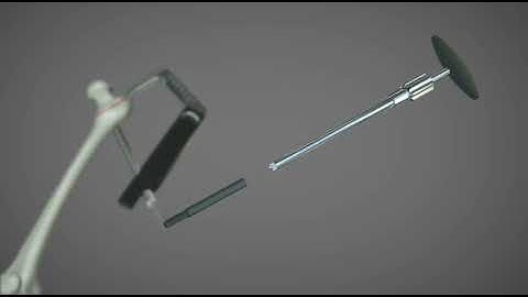 AOS Traditional Trochanteric Nail Surgical Technique