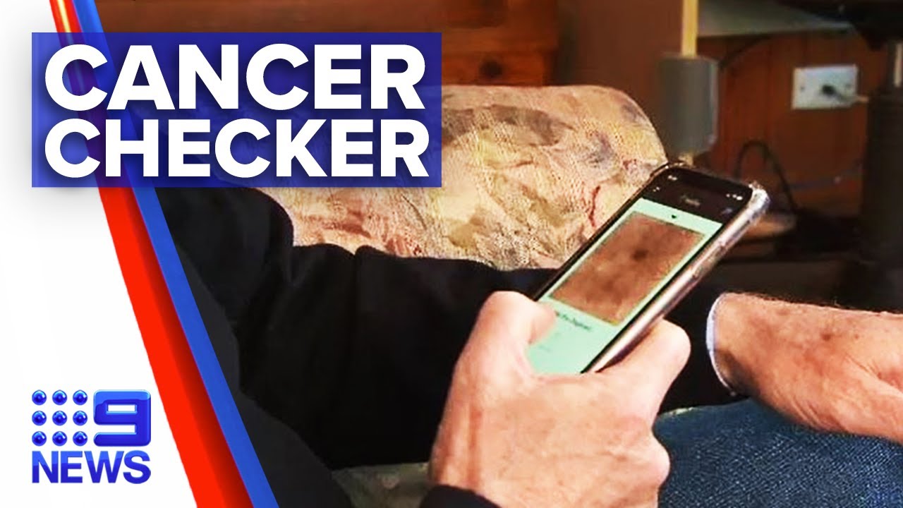 New Skin Cancer Check Technology 9 News Australia YouTube New Skin Cancer Check Technology 9 News Australia YouTube