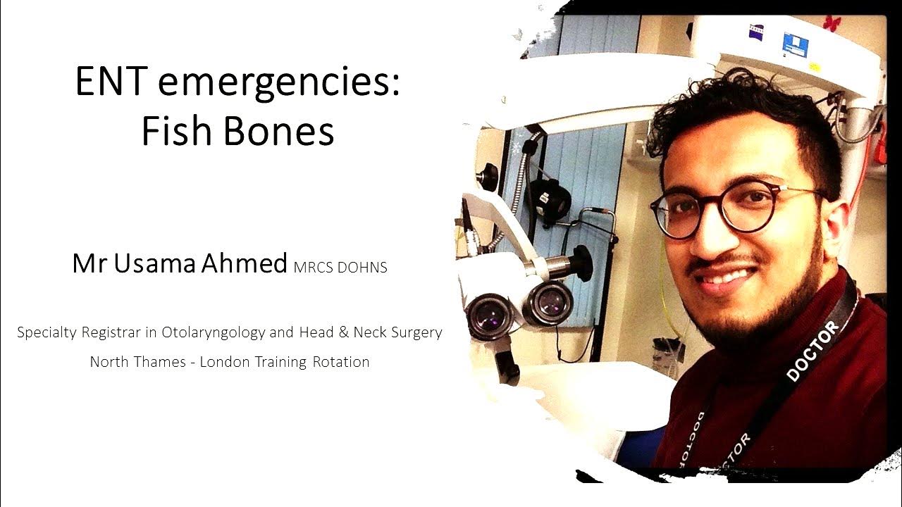 How to remove a fish bone! 1 YouTube