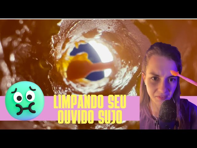 ASMR POV l Limpando o seu ouvido na consulta com a otorrino (realista)