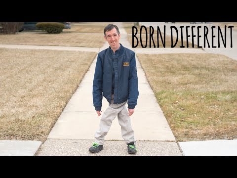 The Incredible Man With Legs Like Scissors | BORN DIFFERENT