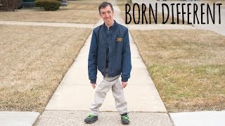 The Incredible Man With Legs Like Scissors | BORN DIFFERENT