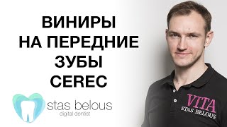 #Стоматолог Стас Белоус #Виниры #Cad/cam  НА ПЕРЕДНИЕ ЗУБЫ Emax #CEREC