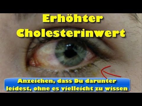 Video: Wie Sehen 100% Ihres Täglichen Cholesterinwerts Aus?