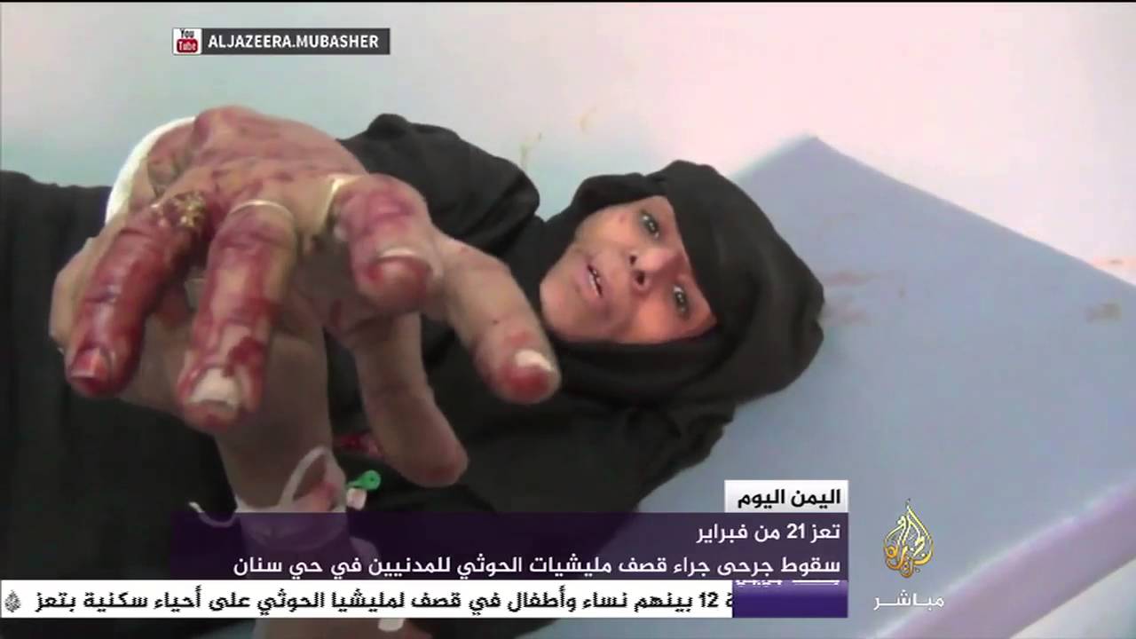 سقوط جرحى جراء قصف مليشيات الحوثي للمدنيين في حي سنان
