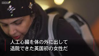 心臓をバックパックで担いで退院　英国女性で初
