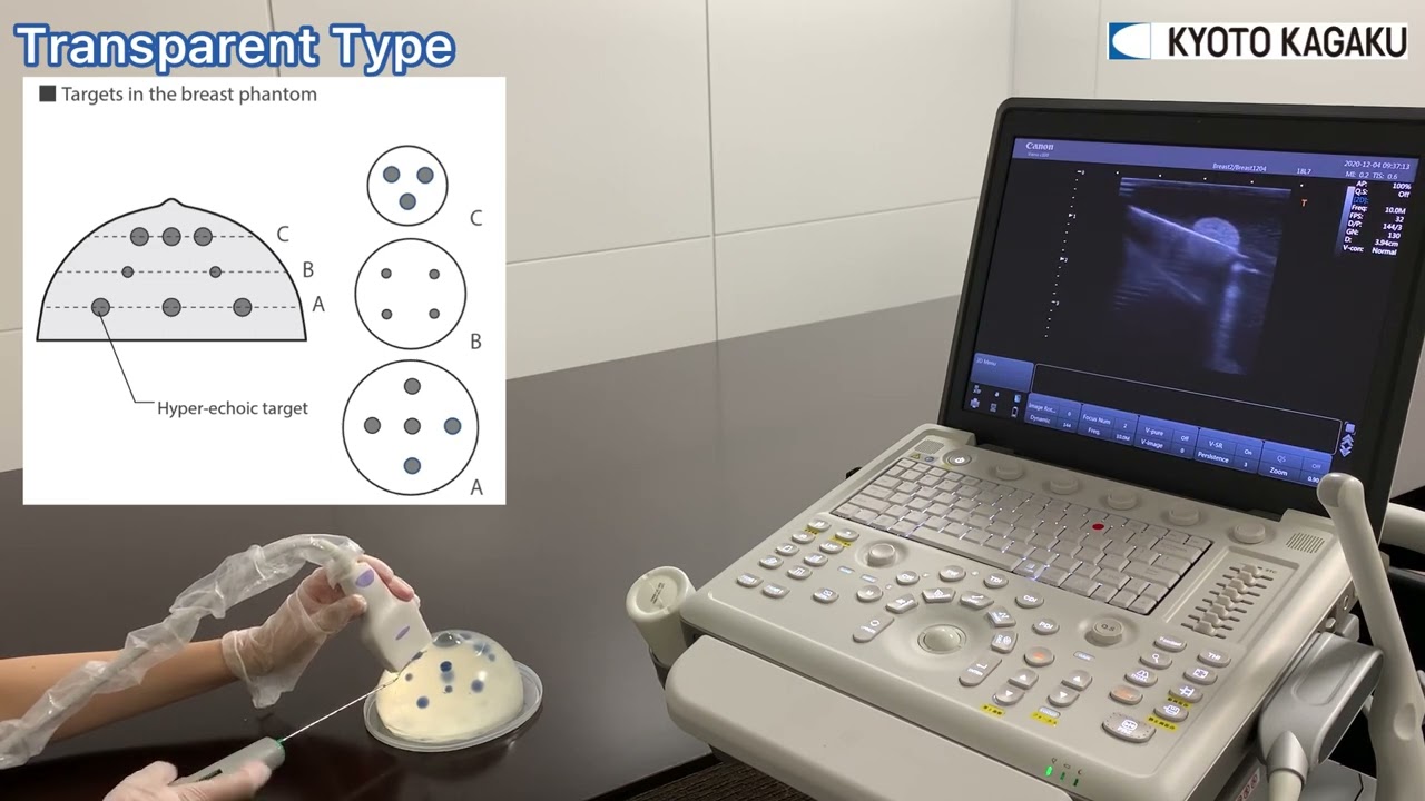 US 9 Ultrasound Guided Breast Biopsy Phantom YouTube US 9 Ultrasound Guided Breast Biopsy Phantom YouTube