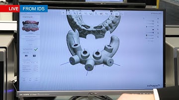 3Shape Implant Studio Software