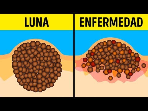 9 Mitos peligrosos sobre lunares y bronceado que aún sigues creyendo