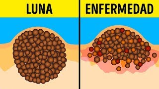 9 Mitos peligrosos sobre lunares y bronceado que aún sigues creyendo