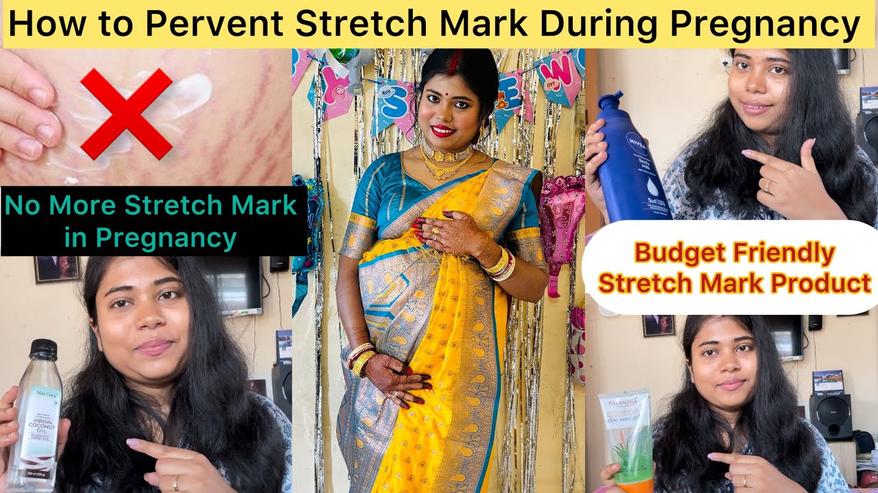 How To Prevent Stretch Mark During Pregnancy|| Budget Friendly Product || Stretch marks