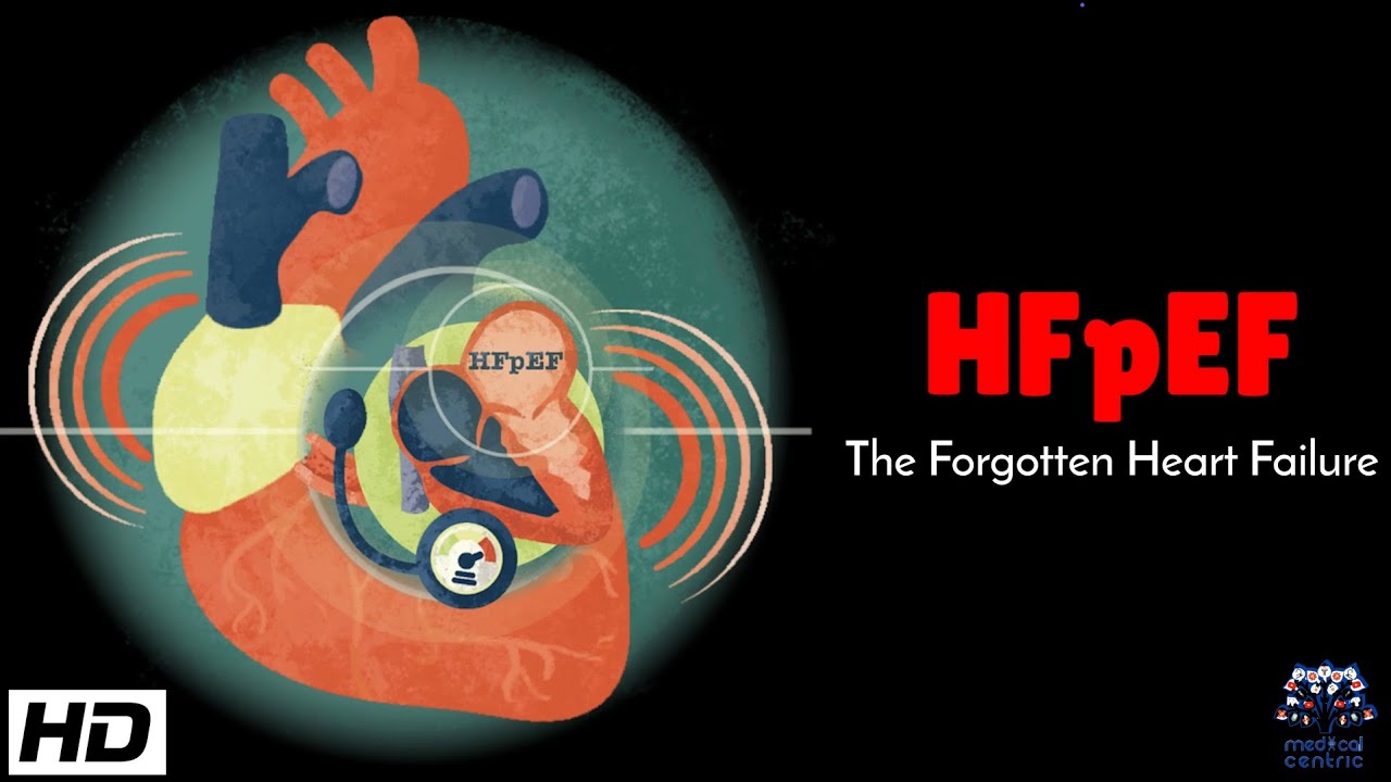 HFpEF : The Forgotten Heart Failure - YouTube