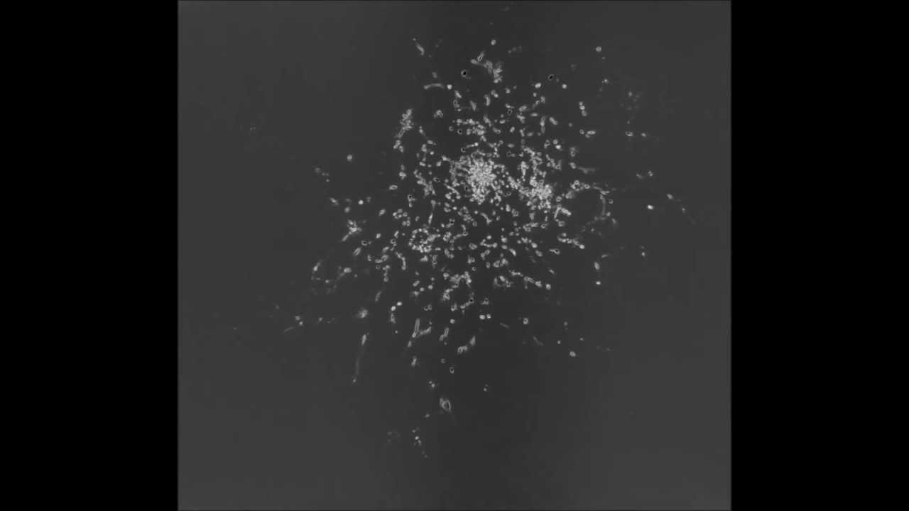 Electrical tree (bush-type) Serial Block-Face SEM cross-sections - YouTube