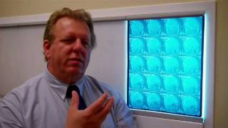 Ask the Expert: Complex Migraines Explained